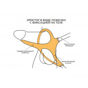 Эректор с фиксацией