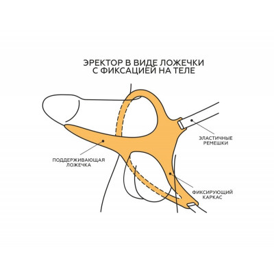 Эректор с фиксацией Эректор с фиксацией